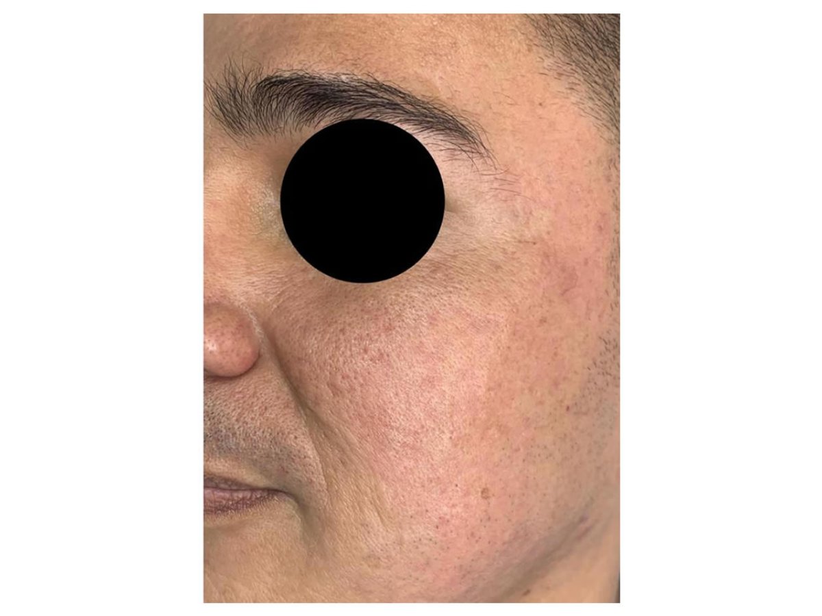 Antes y después — Después