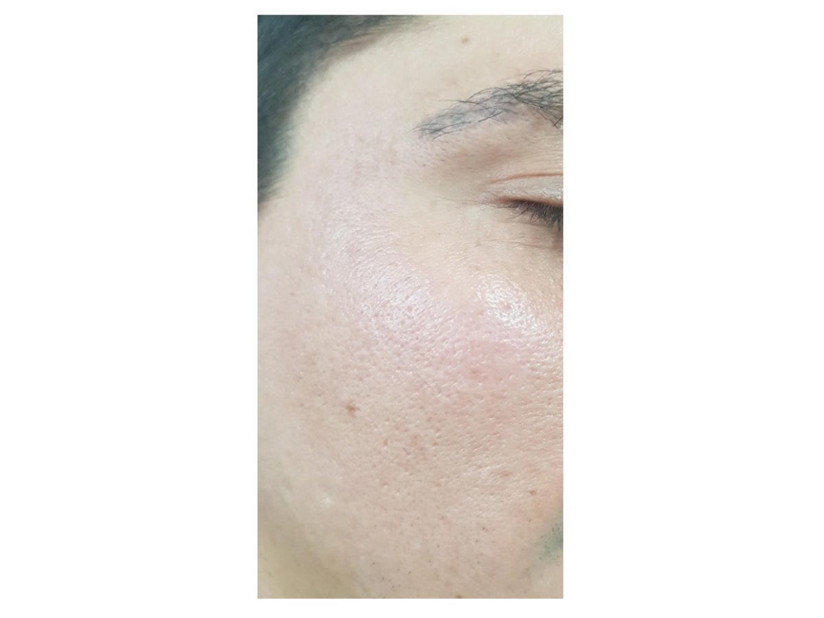 Antes y después — Después