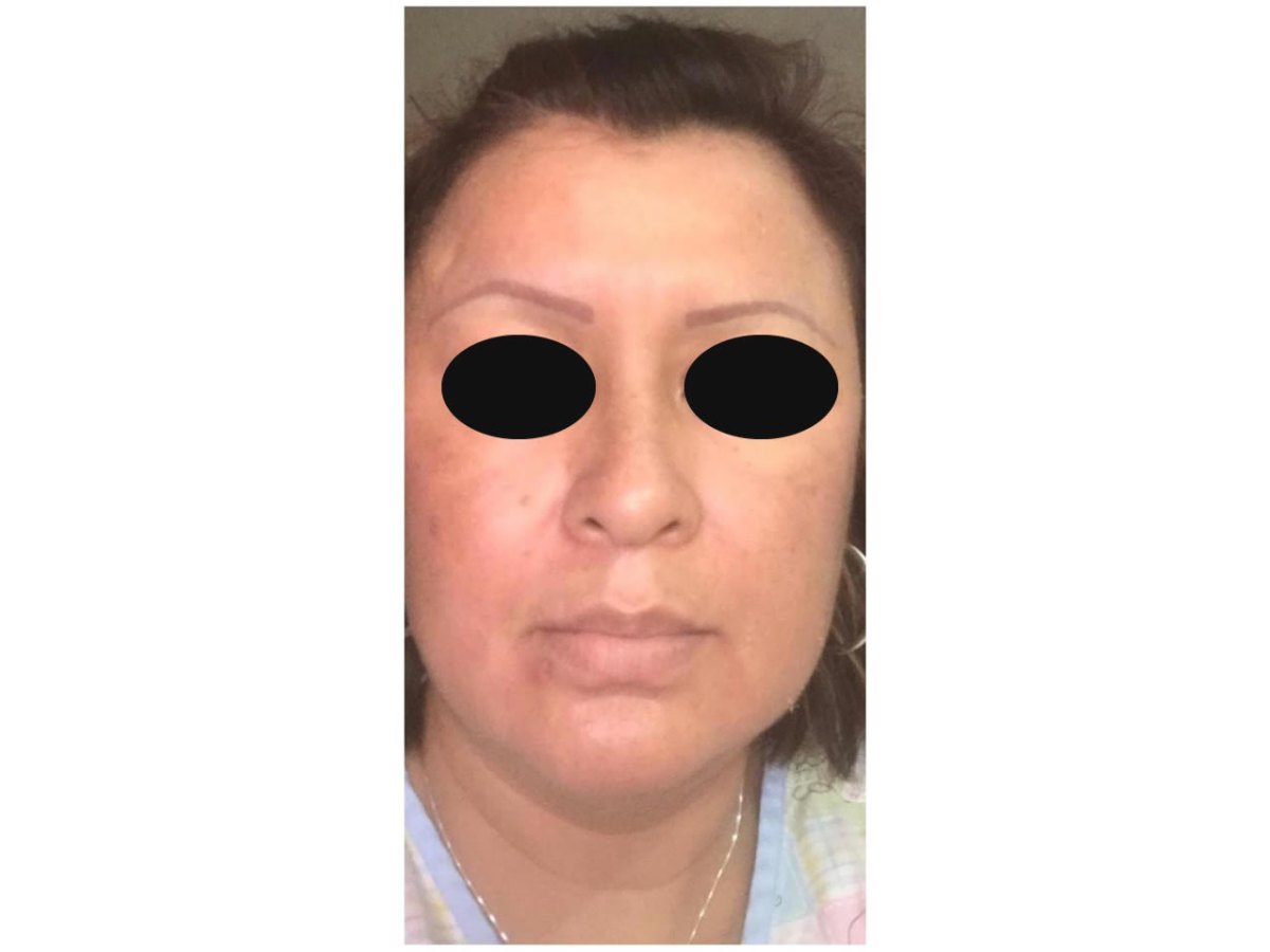 Antes y después — Después