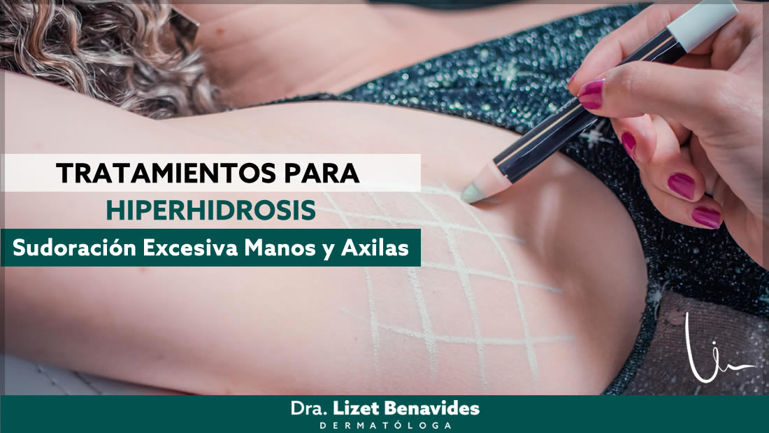 Dra. Lizet Benavides Dermatóloga