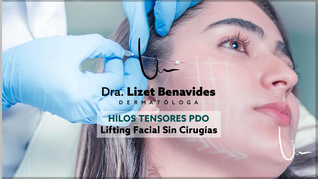 Dra. Lizet Benavides Dermatóloga