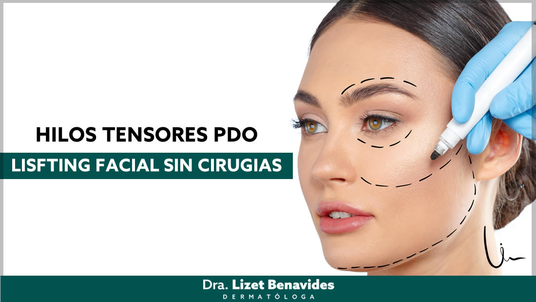 Dra. Lizet Benavides Dermatóloga
