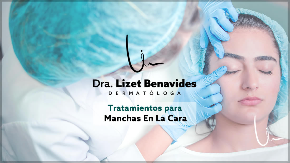 Dra. Lizet Benavides Dermatóloga