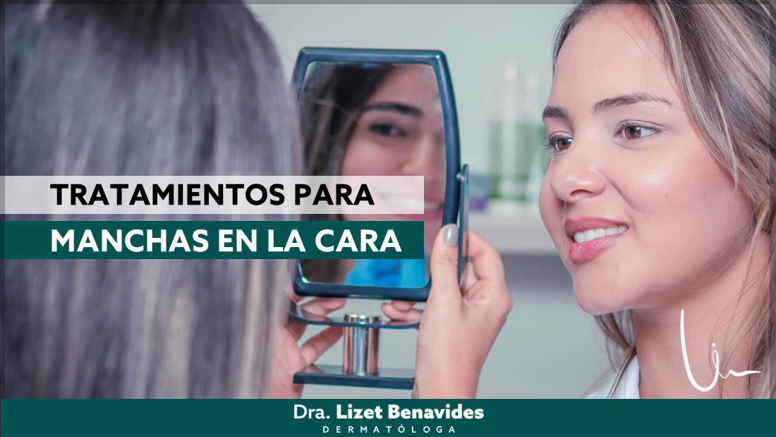 Dra. Lizet Benavides Dermatóloga