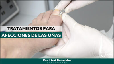 Dra. Lizet Benavides Dermatóloga