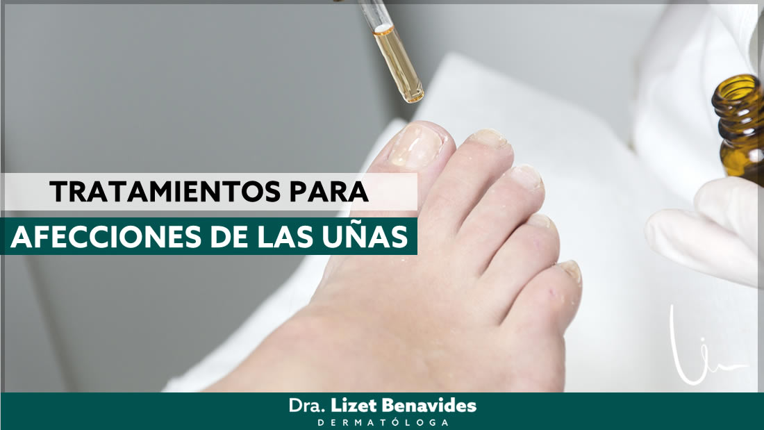 Dra. Lizet Benavides Dermatóloga