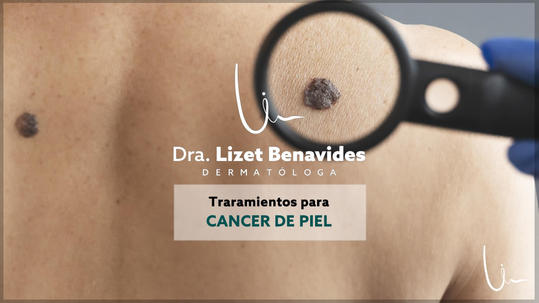 Dra. Lizet Benavides Dermatóloga