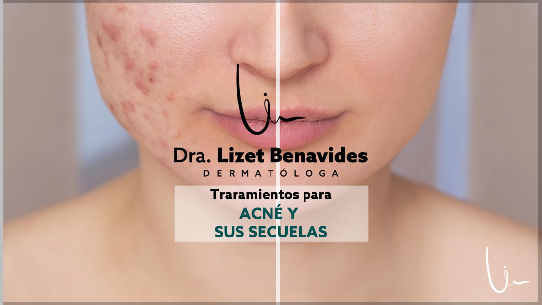 Dra. Lizet Benavides Dermatóloga