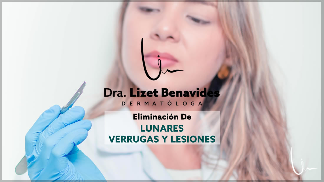 Dra. Lizet Benavides Dermatóloga