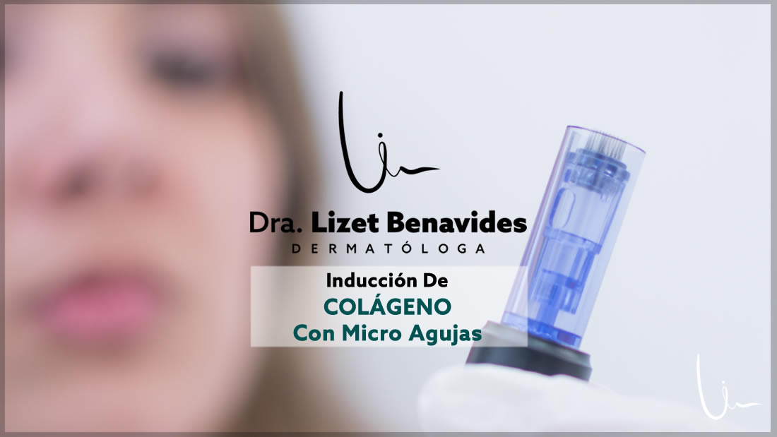 Dra. Lizet Benavides Dermatóloga