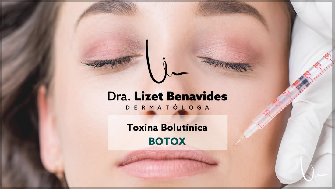 Dra. Lizet Benavides Dermatóloga