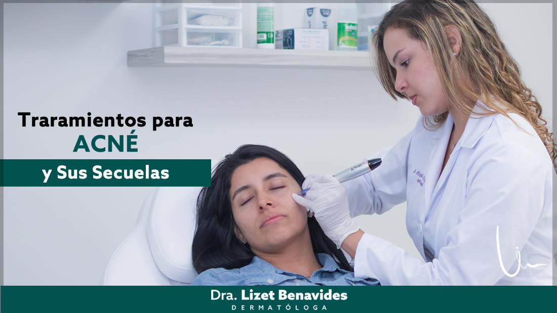 Dra. Lizet Benavides Dermatóloga