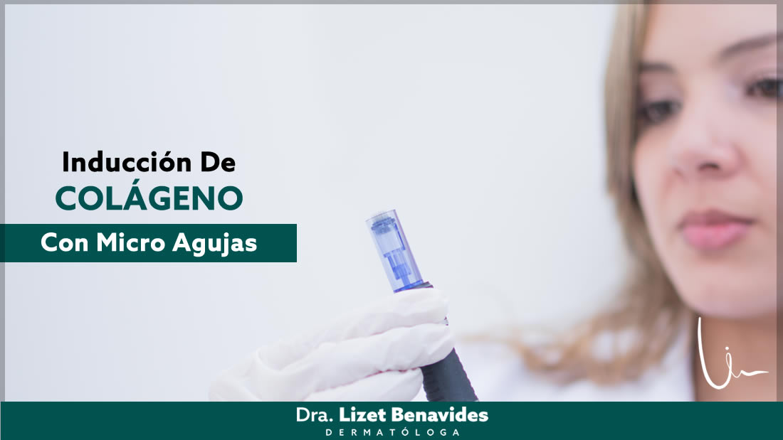 Dra. Lizet Benavides Dermatóloga