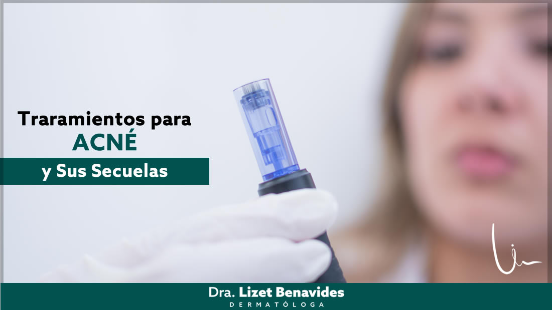 Dra. Lizet Benavides Dermatóloga