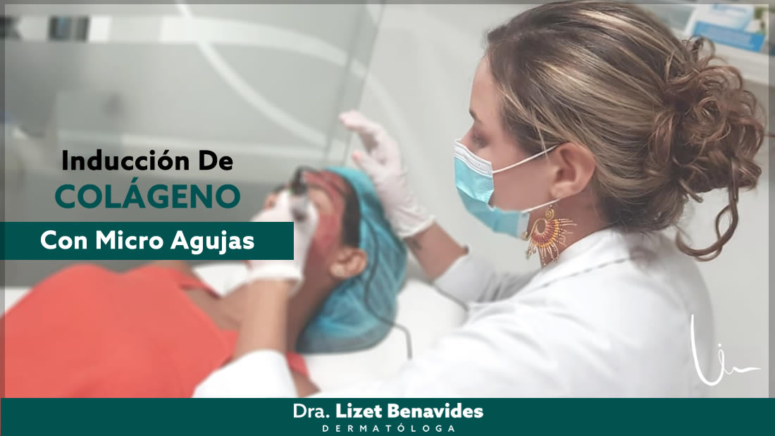 Dra. Lizet Benavides Dermatóloga