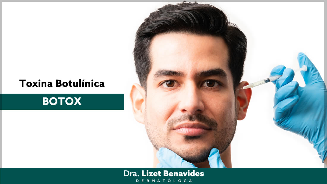 Dra. Lizet Benavides Dermatóloga