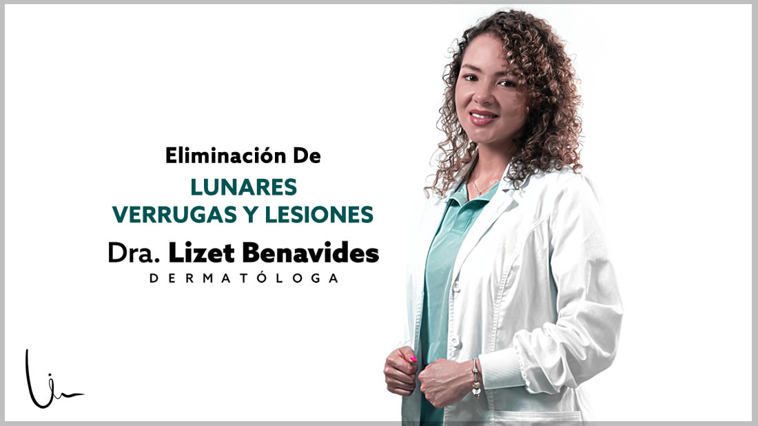 Dra. Lizet Benavides Dermatóloga