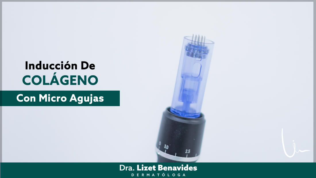 Dra. Lizet Benavides Dermatóloga