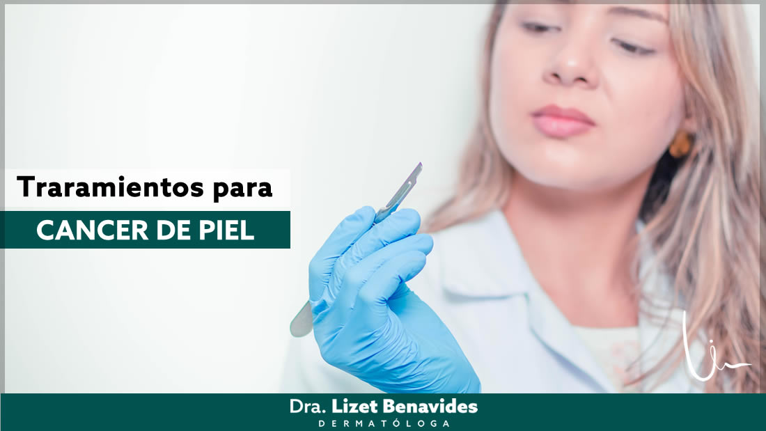 Dra. Lizet Benavides Dermatóloga