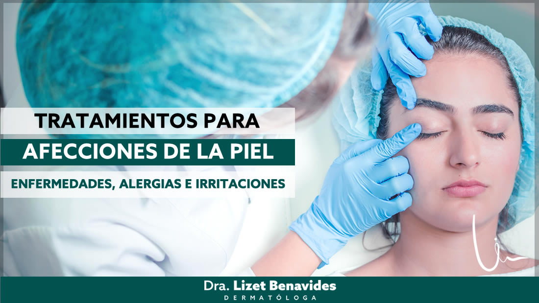 Dra. Lizet Benavides Dermatóloga