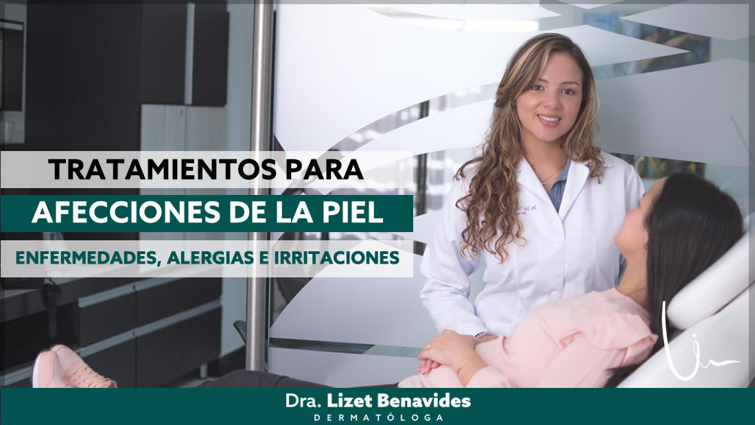 Dra. Lizet Benavides Dermatóloga