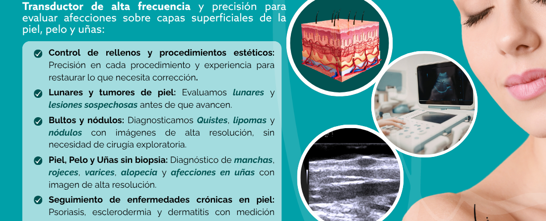 Ecografía Dermatológica En Bucaramanga