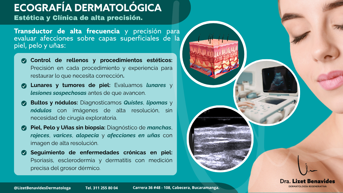 Ecografía Dermatológica En Bucaramanga